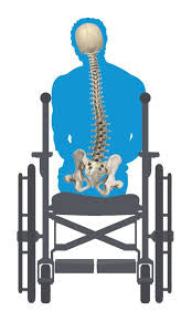 FAQ: Wheelchair Seating